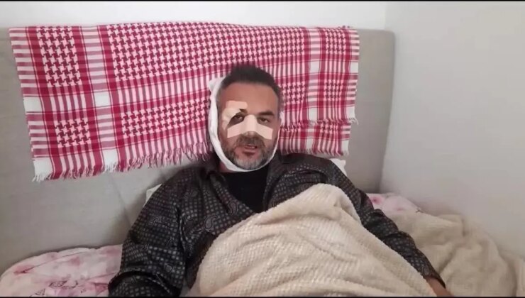 Rize’de Bir Yemek Zinciri Şubesinin Açılışında İsrail’i Protesto Eden Öğretim Görevlisine Saldıran İki Kişi Özgür Bırakıldı