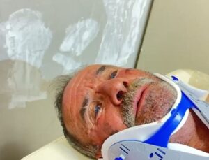 Ayının Saldırısına Nacakla Karşılık Verdi, Yaralı Kurtuldu